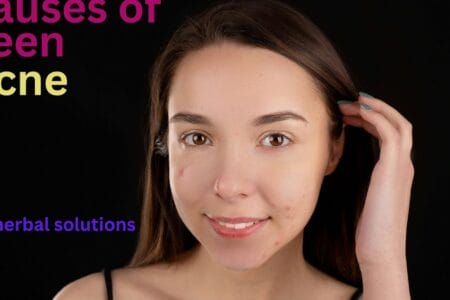 Why do teenagers get acne acne face there?