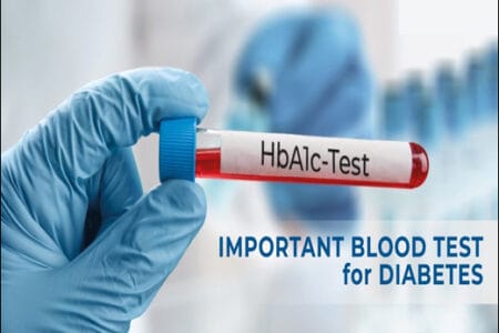 All Blood tests done for Diabetes Mellitus
