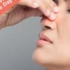 Nasal polyps 101